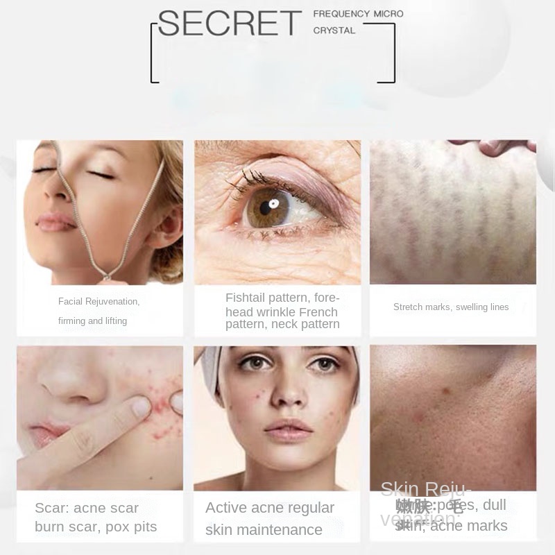 2022 RF Face lifting machine microneedle freckles removal micro needling scars removal gold rf microcrystalline care Beauty · v6